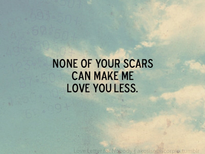 48 none of your scars